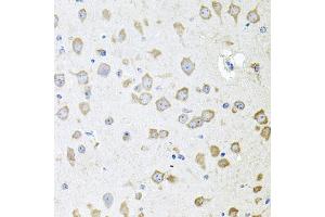 Immunohistochemistry of paraffin-embedded mouse brain using  antibody (ABIN6129179, ABIN6136708, ABIN6136710 and ABIN6222176) at dilution of 1:100 (40x lens). (AKAP5 anticorps  (AA 1-270))