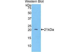 Western Blotting (WB) image for anti-ADAM Metallopeptidase with thrombospondin Type 1 Motif, 12 (ADAMTS12) (AA 827-1001) antibody (ABIN1857901) (ADAMTS12 anticorps  (AA 827-1001))