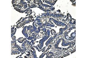IHC analysis of PCK2 using anti-PCK2 antibody (ABIN7599509). (PEPCK anticorps  (AA 1-640))