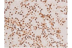 ABIN6267523 at 1/200 staining Rat kidney tissue sections by IHC-P.