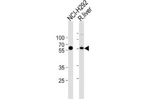 Western Blotting (WB) image for anti-Methylcrotonoyl-CoA Carboxylase 2 (Beta) (MCCC2) antibody (ABIN3002883) (MCCC2 anticorps)