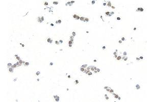 Immunocytochemistry (ICC) image for anti-Bloom Syndrome RecQ Like Helicase (BLM) (C-Term) antibody (ABIN7795726)