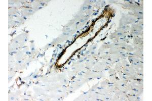 Anti- Vimentin Picoband antibody, IHC(P) IHC(P): Rat Cardiac Muscle Tissue (Vimentin anticorps  (C-Term))