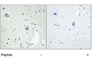 Immunohistochemical analysis of paraffin-embedded Human-Brian , antibody was diluted at 1:100. (D1DR anticorps  (Internal Region))