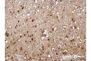 IHC-P Image SKP1 antibody detects SKP1 protein at cytosol and nucleus on mouse middle brain by immunohistochemical analysis. (SKP1 anticorps)