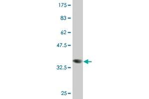 Western Blot detection against Immunogen (37.