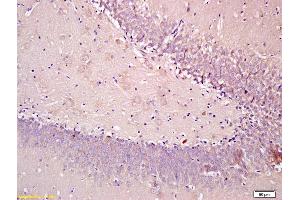 Formalin-fixed and paraffin embedded rat brain tissue labeled with Anti-SEMA4F Polyclonal Antibody, Unconjugated (ABIN1385844) at 1:200, followed by conjugation to the secondary antibody and DAB staining (SEMA4F anticorps  (AA 239-288))