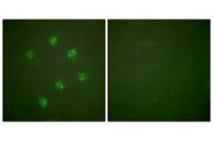 Immunofluorescence analysis of COS7 cells, using Ki67antibody.