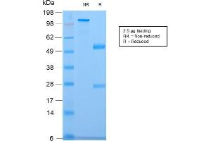 SDS-PAGE Analysis of Purified CELA3B Rabbit Recombinant Monoclonal Antibody (CELA3B/2809R). (Recombinant Elastase 3B anticorps  (AA 82-238))