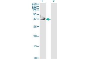 Western Blot analysis of CRYM expression in transfected 293T cell line by CRYM monoclonal antibody (M03), clone 6B3.