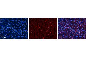 Immunohistochemistry (IHC) image for anti-Cytochrome P450, Family 3, Subfamily A, Polypeptide 4 (CYP3A4) (Middle Region) antibody (ABIN2783885) (CYP3A4 anticorps  (Middle Region))