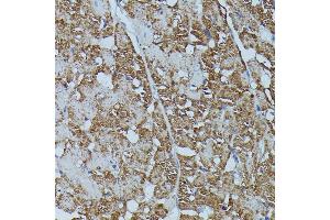 Immunohistochemistry of paraffin-embedded rat heart using FKBP1B antibody (ABIN7267212) at dilution of 1:100 (40x lens).