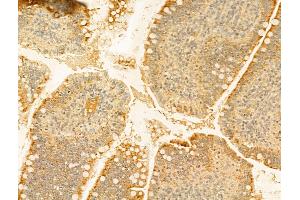ABIN6255185 and ABIN6267483 at 1/100 staining Rat colon tissue by IHC-P. (IRS1 anticorps  (pSer307))