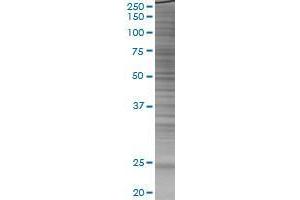 HSPB8 transfected lysate.