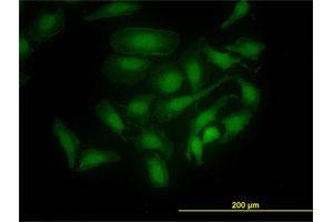 Immunofluorescence of monoclonal antibody to PBK on HeLa cell.