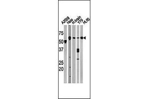 The anti-BECN1 Pab (ABIN388546 and ABIN2849692) is used in Western blot to detect BECN1 in, from left to right, , Hela, mouse brain, Y79, and HL60 tissue lysates. (Beclin 1 anticorps  (AA 210-239))