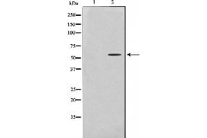 Western blot analysis on HeLa cell lysate using Cytochrome P450 2U1 Antibody，The lane on the left is treated with the antigen-specific peptide. (CYP2U1 anticorps  (Internal Region))