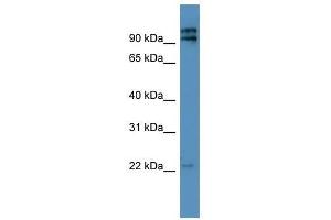 Western Blot showing MRPL49 antibody used at a concentration of 1-2 ug/ml to detect its target protein.
