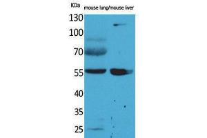 Western Blotting (WB) image for anti-Aldehyde Dehydrogenase 1 Family, Member A1 (ALDH1A1) (N-Term) antibody (ABIN3178188) (ALDH1A1 anticorps  (N-Term))