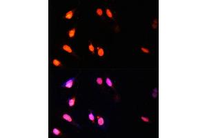 Immunofluorescence analysis of U-2 OS cells using SETD2 Polyclonal Antibody (ABIN3017564, ABIN3017565, ABIN1682666 and ABIN6220156) at dilution of 1:100 (40x lens).