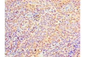 Immunohistochemistry of paraffin-embedded human tonsil tissue using ABIN7174912 at dilution of 1:100 (C9orf163 anticorps  (AA 1-203))