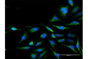 Immunofluorescence of purified MaxPab antibody to DLAT on HeLa cell.