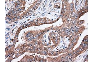 Immunohistochemical staining of paraffin-embedded Human Kidney tissue using anti-TTC32 mouse monoclonal antibody. (TTC32 anticorps)