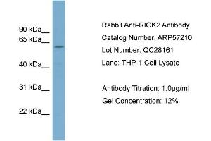 WB Suggested Anti-RIOK2  Antibody Titration: 0. (RIOK2 anticorps  (Middle Region))