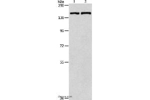 Western blot analysis of Hela cell and mouse lung tissue, using PTCH1 Polyclonal Antibody at dilution of 1:900 (Patched 1 anticorps)