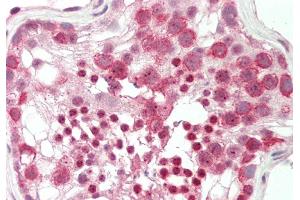 Rabbit Anti-MBD1 antibody  Formalin Fixed Paraffin Embedded Tissue: Human Testis Primary antibody Concentration: 1:100 Secondary Antibody: Donkey anti-Rabbit-Cy3 Secondary Antibody Concentration: 1:200 Magnification: 20x Exposure Time: 0.