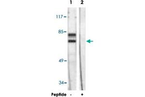 Western blot analysis of extracts from HeLa cells, using LMNA polyclonal antibody . (Lamin A/C anticorps)