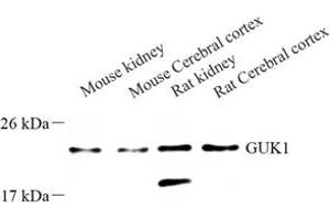 Western blot analysis of GUK1 (ABIN7074153) at dilution of 1: 500