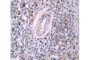 Used in DAB staining on fromalin fixed paraffin- embedded stomach cancer tissue (SFRP4 anticorps  (AA 25-222))