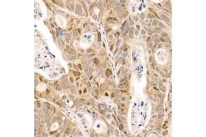 Immunohistochemistry of paraffin-embedded mouse kidney using α-Tubulin Rabbit mAb (ABIN7271036) at dilution of 1:100 (40x lens).