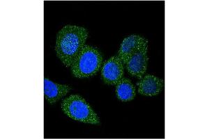 Image no. 3 for anti-Acyl-CoA Synthetase Long-Chain Family Member 4 (ACSL4) (AA 244-274) antibody (ABIN357780)