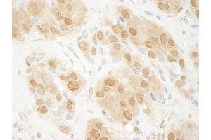 Immunohistochemistry (IHC) image for anti-Mitogen-Activated Protein Kinase 3 (MAPK3) (AA 329-379) antibody (ABIN7453702)