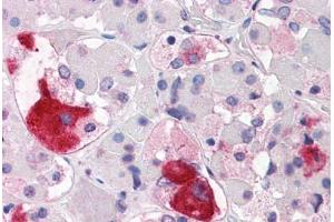 Anti-CRHR2 antibody  ABIN1048464 IHC staining of human brain, pituitary.