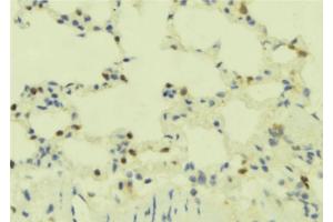 ABIN6273893 at 1/100 staining Mouse lung tissue by IHC-P.