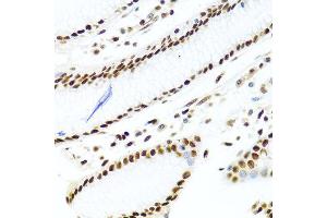 Immunohistochemistry of paraffin-embedded human stomach using SSB antibody at dilution of 1:100 (40x lens). (SSB anticorps)