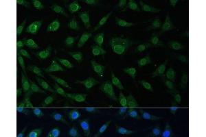 Immunofluorescence analysis of L929 cells using NUP214 Polyclonal Antibody at dilution of 1:100 (40x lens). (NUP214 anticorps)