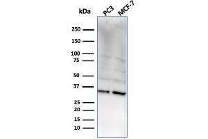 Western Blot Analysis of PC3 and MCF-7 cell lysate using NKX2. (NKX2-8 anticorps  (AA 10-123))