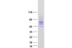 Validation with Western Blot