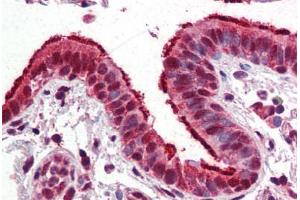 Human Lung, Respiratory Epithelium (formalin-fixed, paraffin-embedded) stained with FOXP1 antibody ABIN364260 at 10 ug/ml followed by biotinylated anti-mouse IgG secondary antibody ABIN481714, alkaline phosphatase-streptavidin and chromogen. (FOXP1 anticorps)