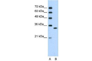 WB Suggested Anti-RNASEH2A  Antibody Titration: 0.