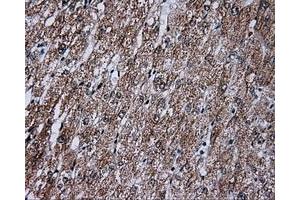 Immunohistochemical staining of paraffin-embedded liver tissue using anti-FAHD2A mouse monoclonal antibody. (FAHD2A anticorps)