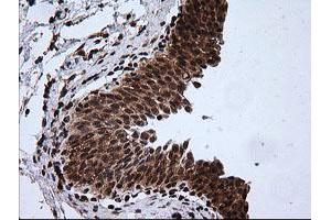 Image no. 3 for anti-Rhotekin (RTKN) antibody (ABIN1500702) (Rhotekin anticorps)