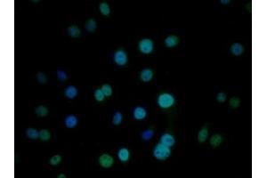Detection of CIRBP in Human HepG2 cell using Polyclonal Antibody to Cold Inducible RNA Binding Protein (CIRBP)
