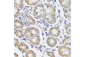 Immunohistochemistry of paraffin-embedded human stomach using CTSC antibody (ABIN5974676) at dilution of 1/100 (40x lens). (CTSC anticorps)