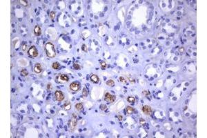 Image no. 5 for anti-Tumor Necrosis Factor Receptor Superfamily, Member 8 (TNFRSF8) (AA 19-379) antibody (ABIN1491085)