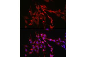 Immunofluorescence analysis of PC-12 cells using Inhibin beta A (INHBA) Rabbit pAb (ABIN6129032, ABIN6142459, ABIN6142460 and ABIN6221533) at dilution of 1:50 (40x lens).